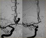 interventional
