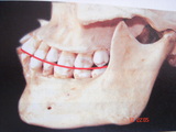 the DENTIST