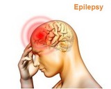 Buy Epilepsy Medications Online in Canada