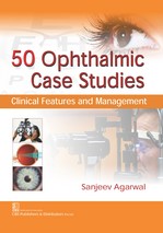 50 Ophthalmic Case Studies Clinical Features And Management