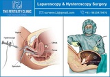 Best Laparoscopy & Hysteroscopy Surgery in India
