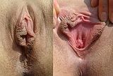 genitalia