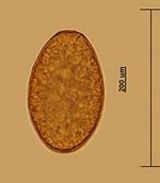 Fascioloides magna